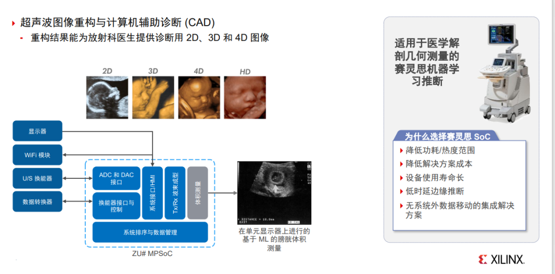 在医疗行业中,FPGA扮演什么角色? - 第6张