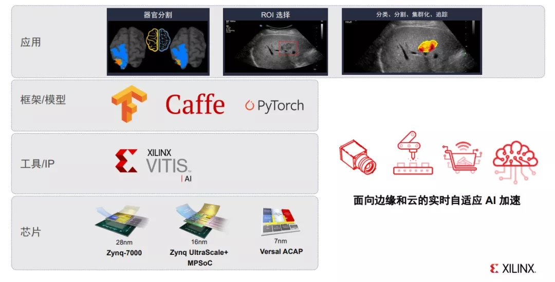 在医疗行业中,FPGA扮演什么角色? - 第7张
